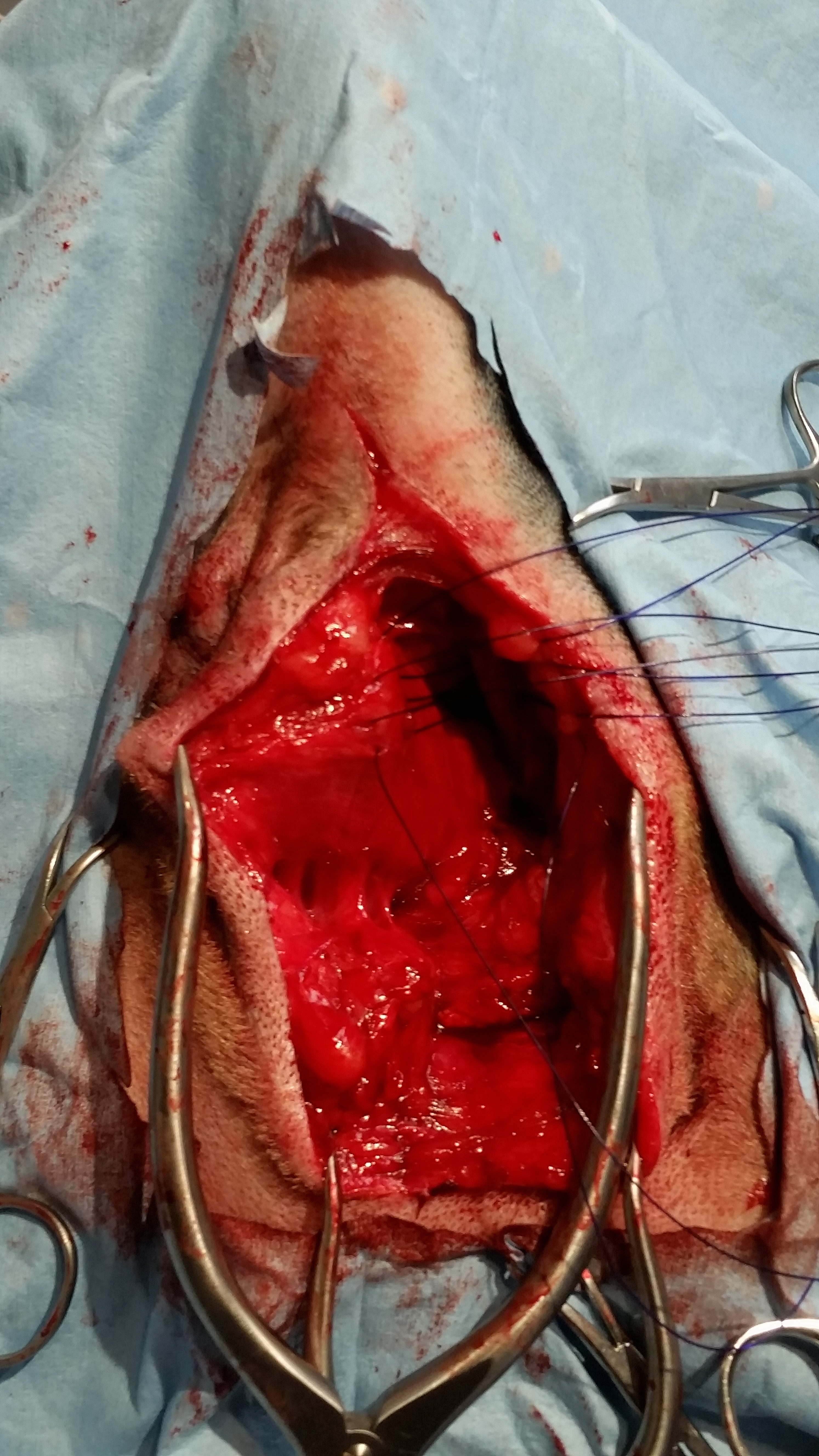 perineal hernia repair